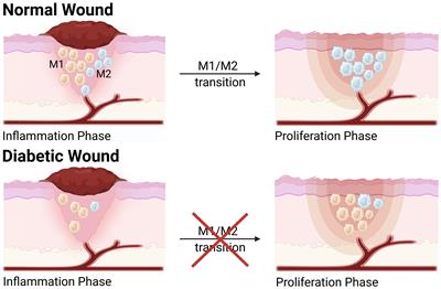 Histone modifications and their roles in macrophage-mediated inflammation: a new target for diabetic wound healing
